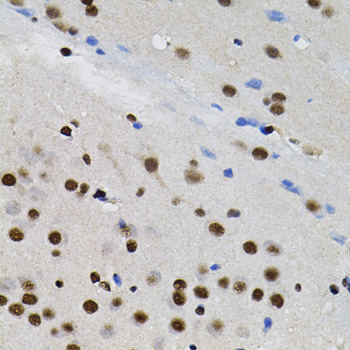 GTF2I Rabbit polyclonal antibody