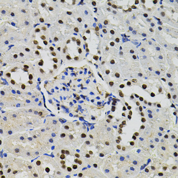 GTF2I Rabbit polyclonal antibody