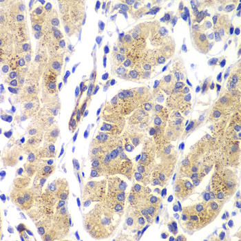 HRAS Rabbit polyclonal antibody
