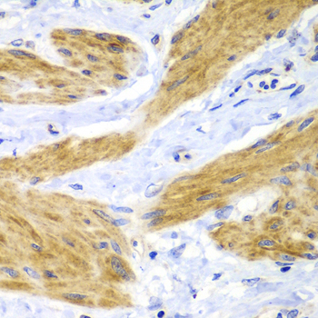HRAS Rabbit polyclonal antibody
