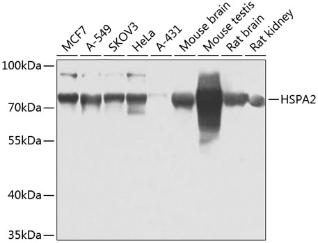 HSPA2 Rabbit polyclonal antibody