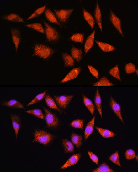HSPA2 Rabbit polyclonal antibody