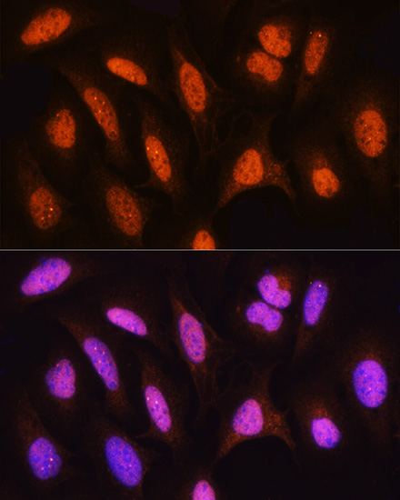 HSPA2 Rabbit polyclonal antibody