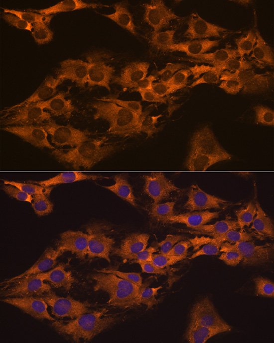 CAPRIN1 Rabbit polyclonal antibody