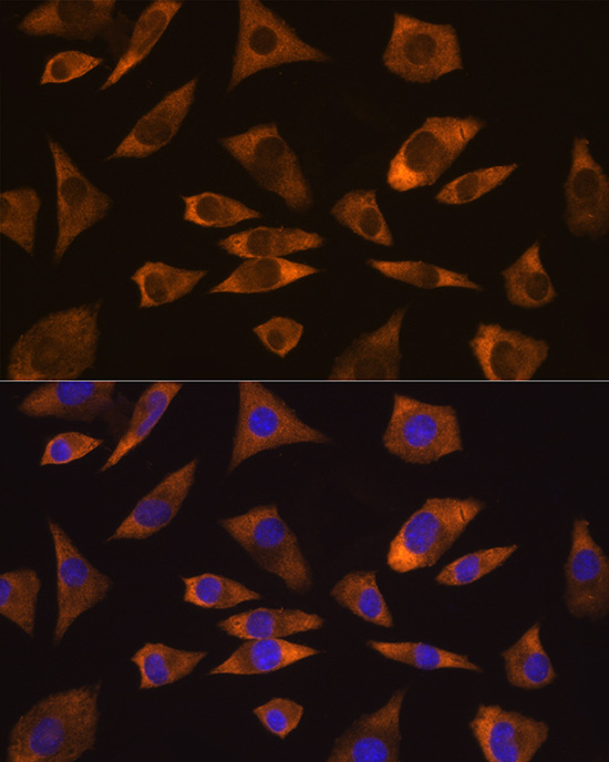 CAPRIN1 Rabbit polyclonal antibody