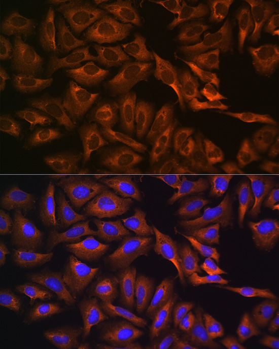CAPRIN1 Rabbit polyclonal antibody