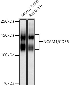 NCAM1 / CD56 Rabbit polyclonal antibody