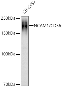 NCAM1 / CD56 Rabbit polyclonal antibody