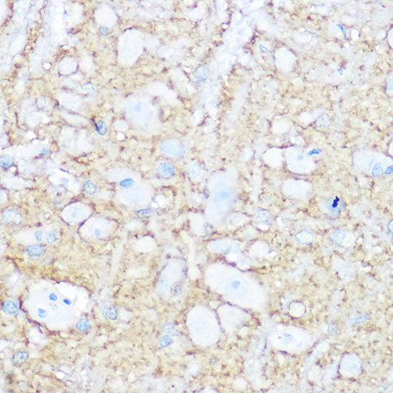 NCAM1 / CD56 Rabbit polyclonal antibody