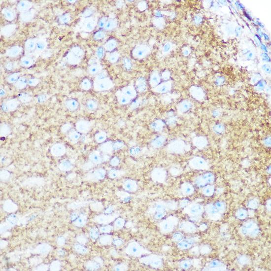NCAM1 / CD56 Rabbit polyclonal antibody