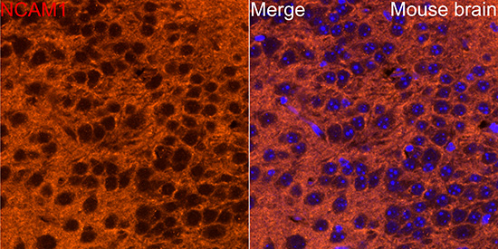 NCAM1 / CD56 Rabbit polyclonal antibody