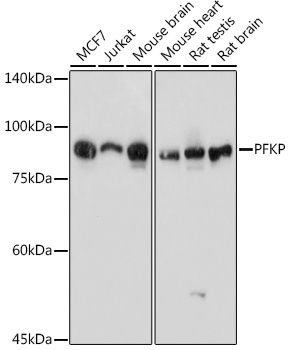 PFKP Rabbit polyclonal antibody