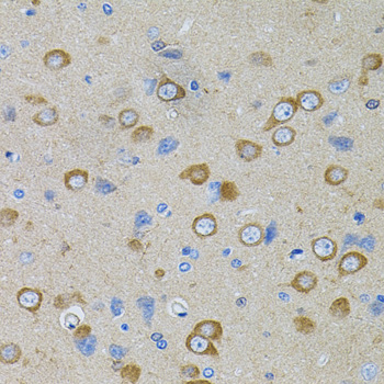 PFKP Rabbit polyclonal antibody