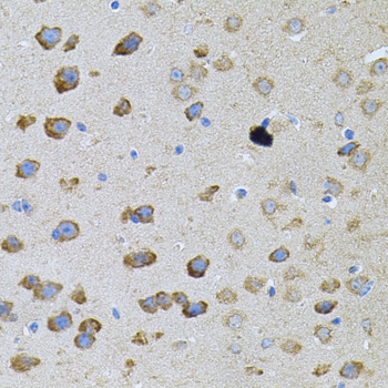 PFKP Rabbit polyclonal antibody