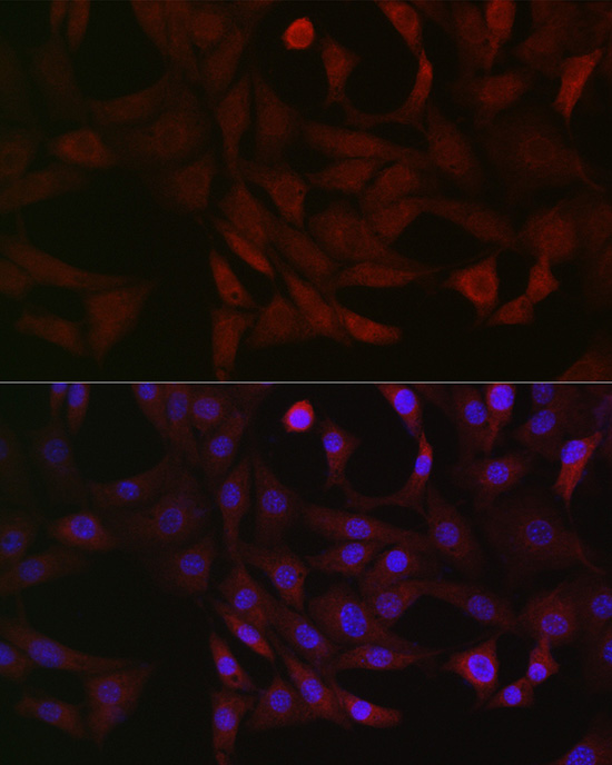 PFKP Rabbit polyclonal antibody