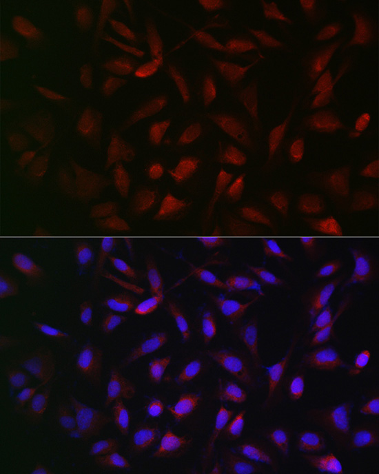 PFKP Rabbit polyclonal antibody