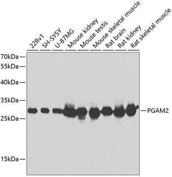 PGAM2 Rabbit polyclonal antibody