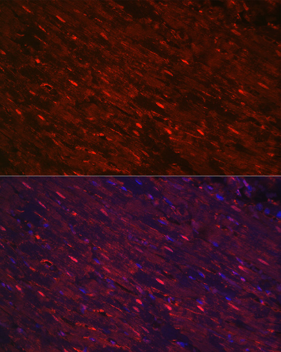 PGAM2 Rabbit polyclonal antibody