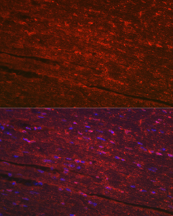 PGAM2 Rabbit polyclonal antibody