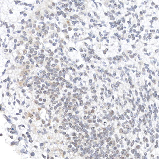 OCT4 Rabbit polyclonal antibody