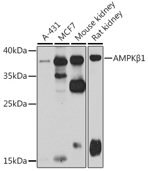 AMPKB Beta1 Rabbit polyclonal antibody