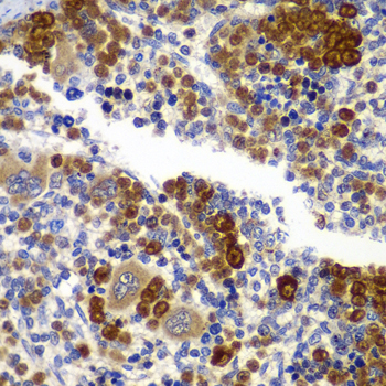 AMPKB Beta1 Rabbit polyclonal antibody