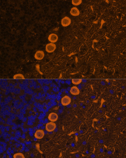 PKC gamma Rabbit polyclonal antibody