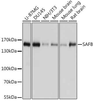 SAFB Rabbit polyclonal antibody