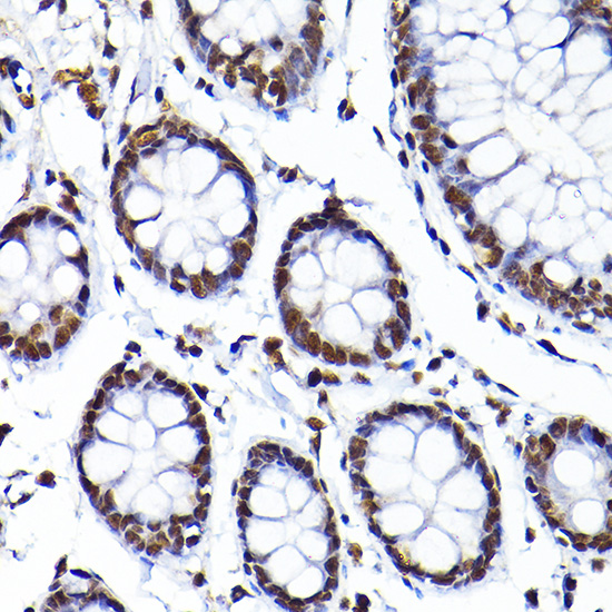 SAFB Rabbit polyclonal antibody