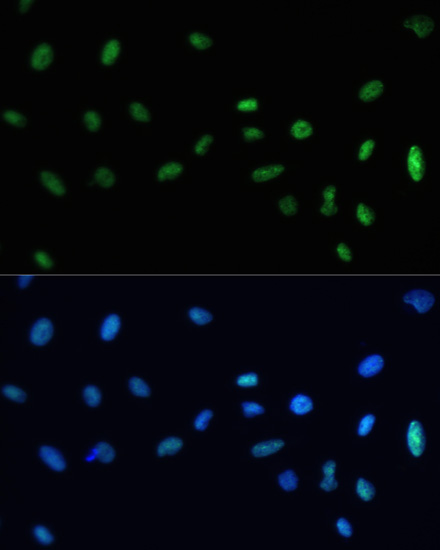 SAFB Rabbit polyclonal antibody