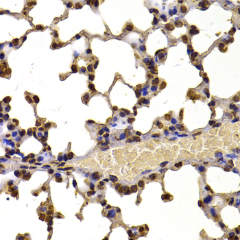 WHSC1 Rabbit polyclonal antibody