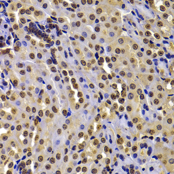 WHSC1 Rabbit polyclonal antibody