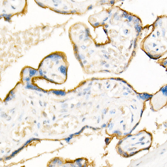 ADAM12 Rabbit polyclonal antibody