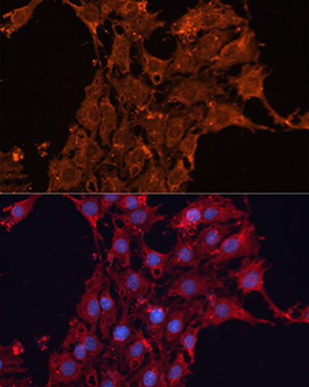 ADAM12 Rabbit polyclonal antibody