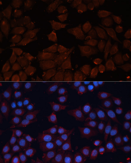ADAM12 Rabbit polyclonal antibody