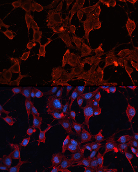 ADAM12 Rabbit polyclonal antibody