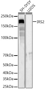 IRS2 Rabbit polyclonal antibody
