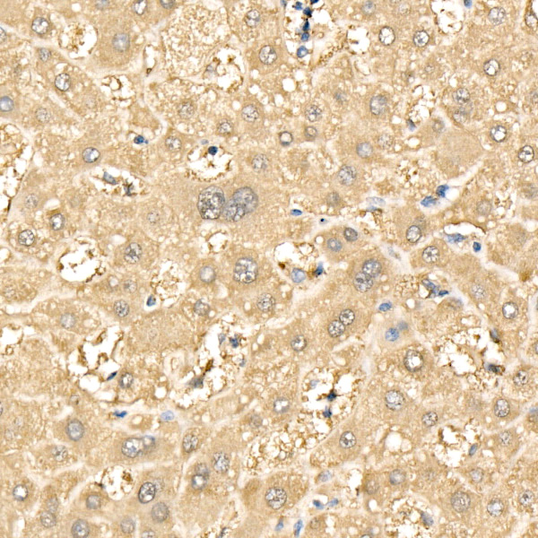 IRS2 Rabbit polyclonal antibody