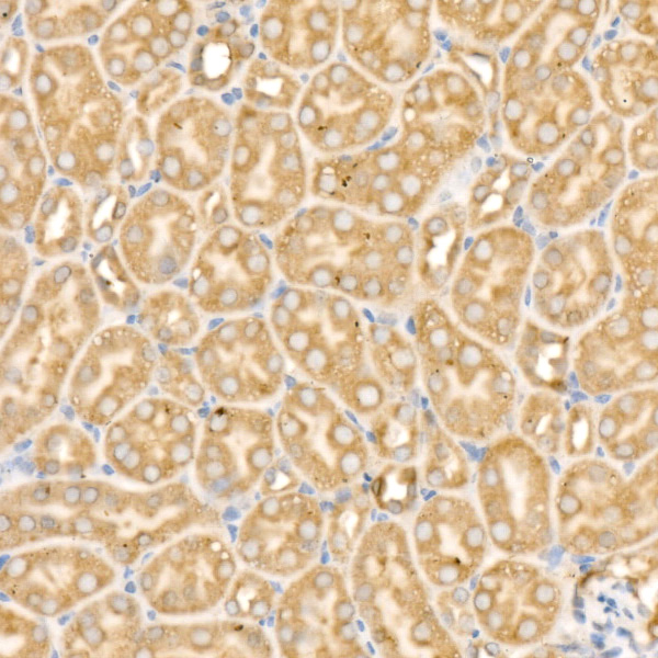 IRS2 Rabbit polyclonal antibody