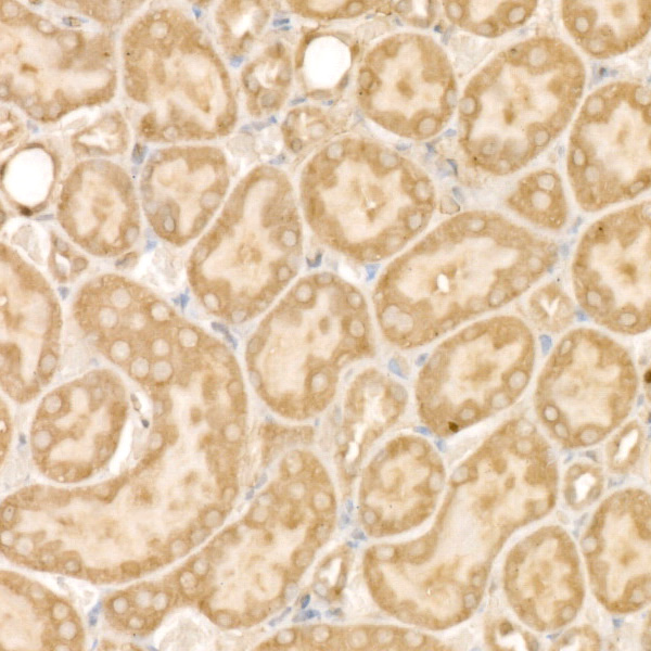 IRS2 Rabbit polyclonal antibody