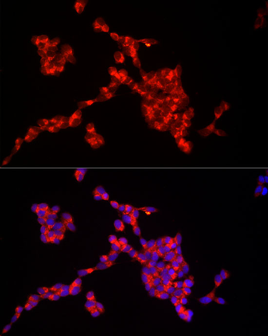 IRS2 Rabbit polyclonal antibody
