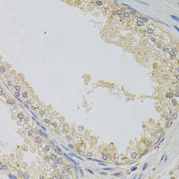 Alpha SNAP Rabbit polyclonal antibody