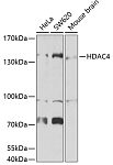 Western blot - HDAC4 Rabbit pAb (A7951)