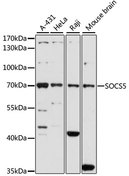 SOCS5 Rabbit polyclonal antibody