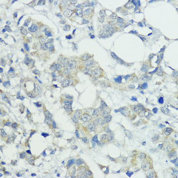 SOCS5 Rabbit polyclonal antibody