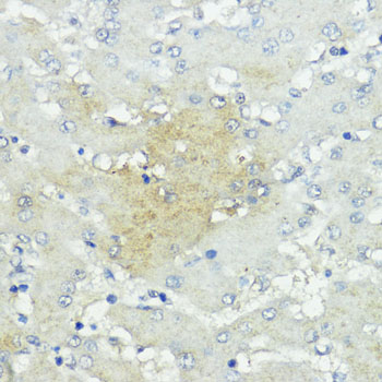 SOCS5 Rabbit polyclonal antibody