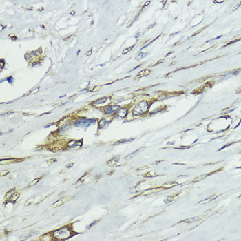 SOCS5 Rabbit polyclonal antibody