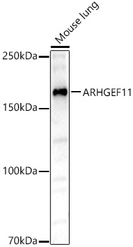 ARHGEF11 Rabbit polyclonal antibody