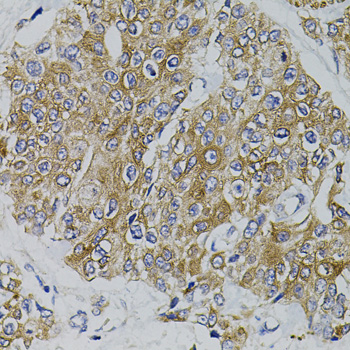 ARHGEF11 Rabbit polyclonal antibody
