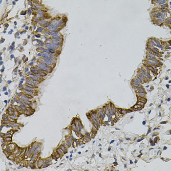 ARHGEF11 Rabbit polyclonal antibody